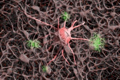 нерви нервни клетки алцхаймер